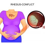 Incompatibilitatea Rh in sarcina
