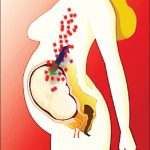 Transferul bi-direcțional de celule feto-maternale prin placentă